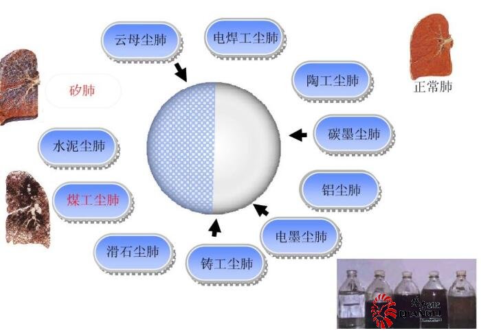 礦用濾塵送風式防塵口罩：開辟個體粉塵安全防護新時代